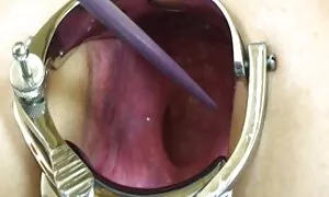எல்மரின் மனைவியிடமிர ...