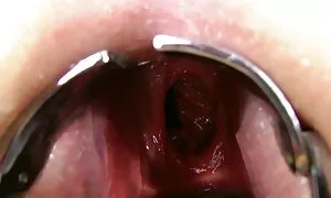 இரட்டை குத ஃபிஸ்டிங் ...
