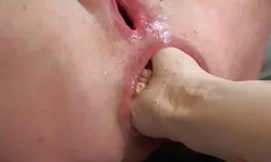 கழுதை குத மெக்சிகன்  ...